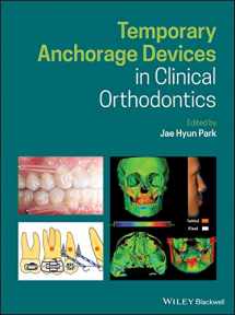 9781119513476-1119513472-Temporary Anchorage Devices in Clinical Orthodontics