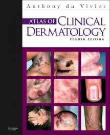 9780702034213-0702034215-Atlas of Clinical Dermatology