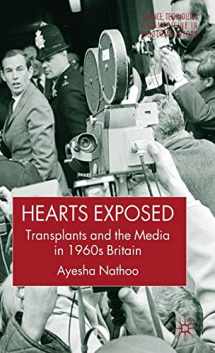 9781403987303-1403987300-Hearts Exposed: Transplants and the Media in 1960s Britain (Science, Technology and Medicine in Modern History)