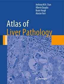 9781461491132-1461491134-Atlas of Liver Pathology (Atlas of Anatomic Pathology)