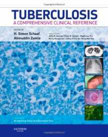 9781416039884-1416039880-Tuberculosis: A Comprehensive Clinical Reference