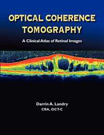 9780984193448-0984193448-Optical Coherence Tomography: A Clinical Atlas of Retinal Images