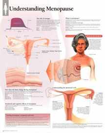 9781930633612-1930633610-Understanding Menopause chart: Laminated Wall Chart