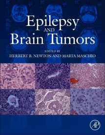 9780124170438-0124170439-Epilepsy and Brain Tumors