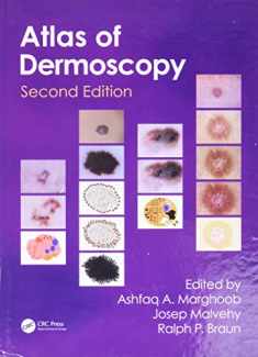 An Atlas of Dermoscopy