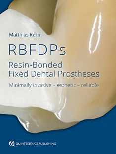 RBFDPs: Resin-Bonded Fixed Dental Prostheses: Minimally Invasive - Esthetic - Reliable