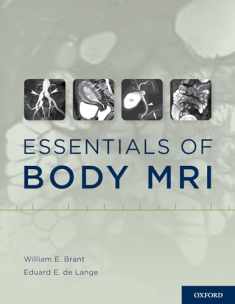 Essentials of Body MRI