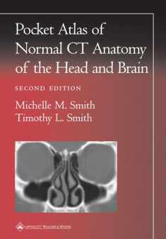 Pocket Atlas of Normal CT Anatomy of the Head and Brain (Radiology Pocket Atlas Series)