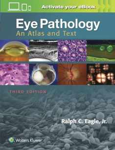 Eye Pathology: An Atlas and Text