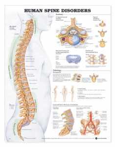 ACC Human Spine Disorders Anatomical Chart