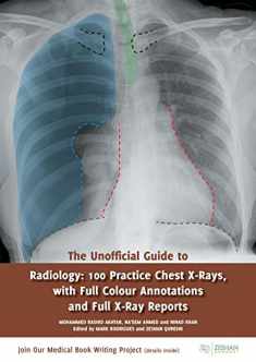 The Unofficial Guide to Radiology: 100 Practice Chest X Rays with Full Colour Annotations and Full X Ray Reports (Unofficial Guides)