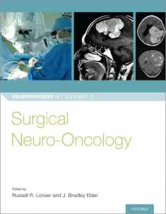 Surgical Neuro-Oncology (Neurosurgery by Example)